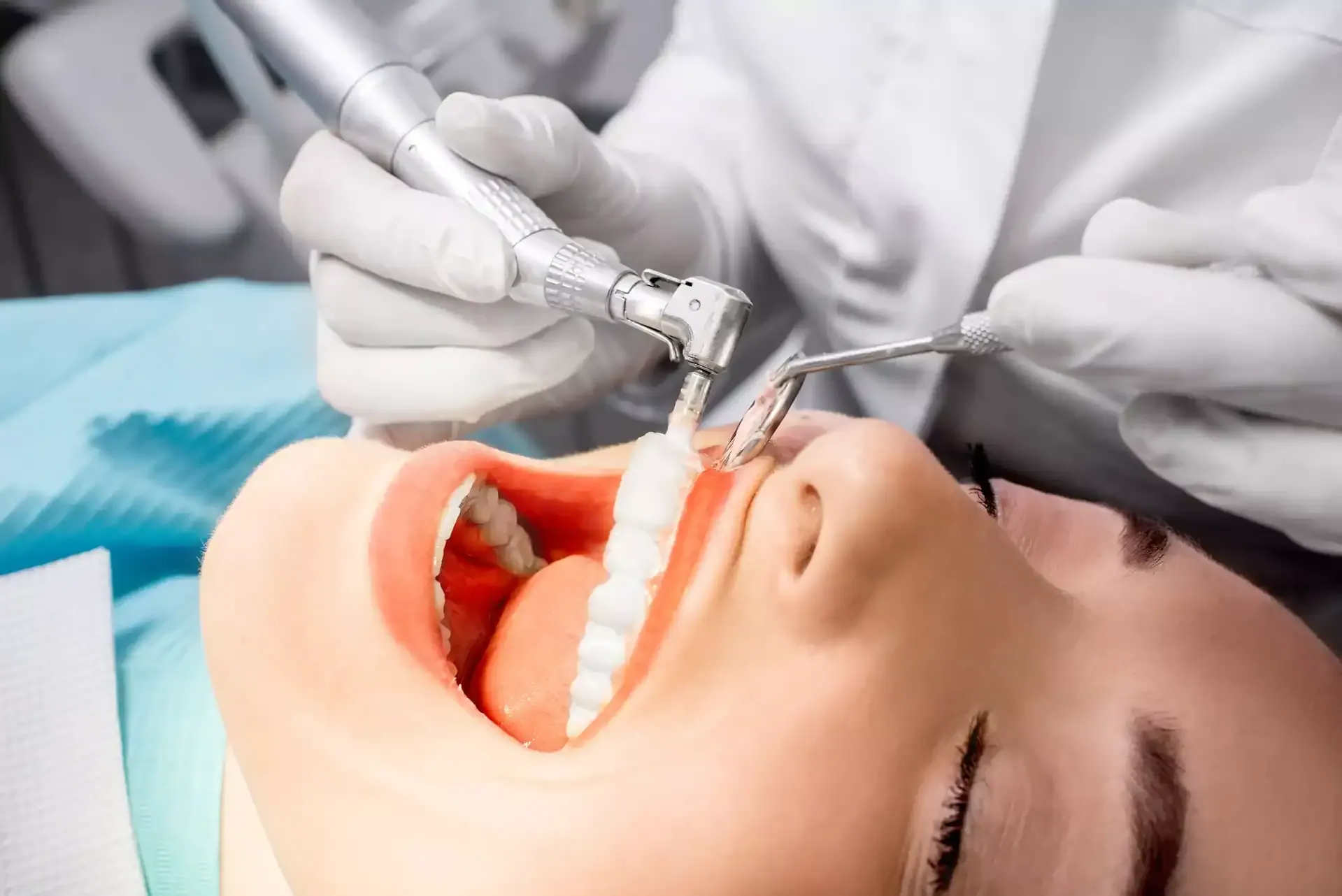 Professionelle Zahnreinigung PZR bei topDentis COlogne