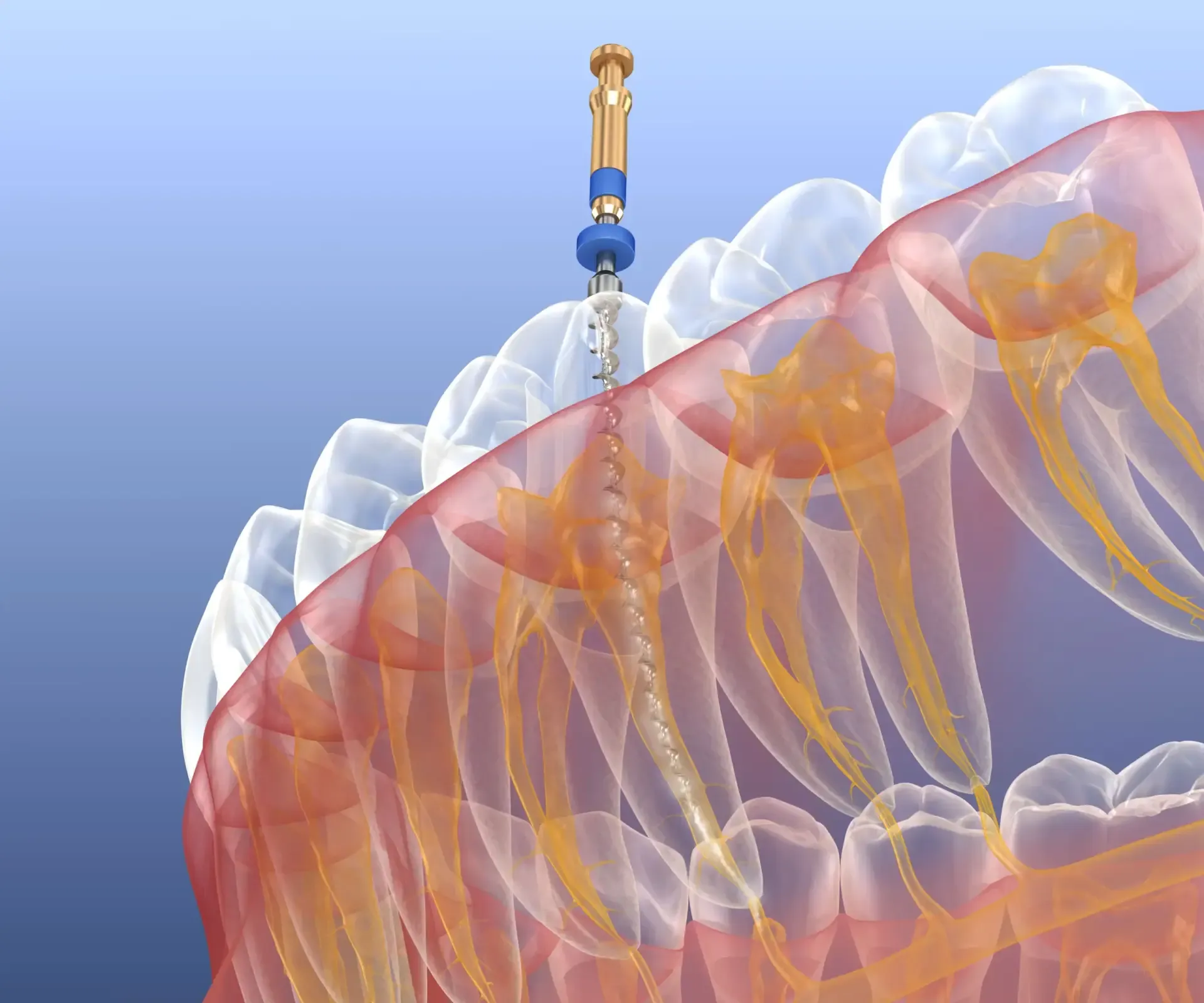 Zahnerhalt in Köln - Endodontie Köln