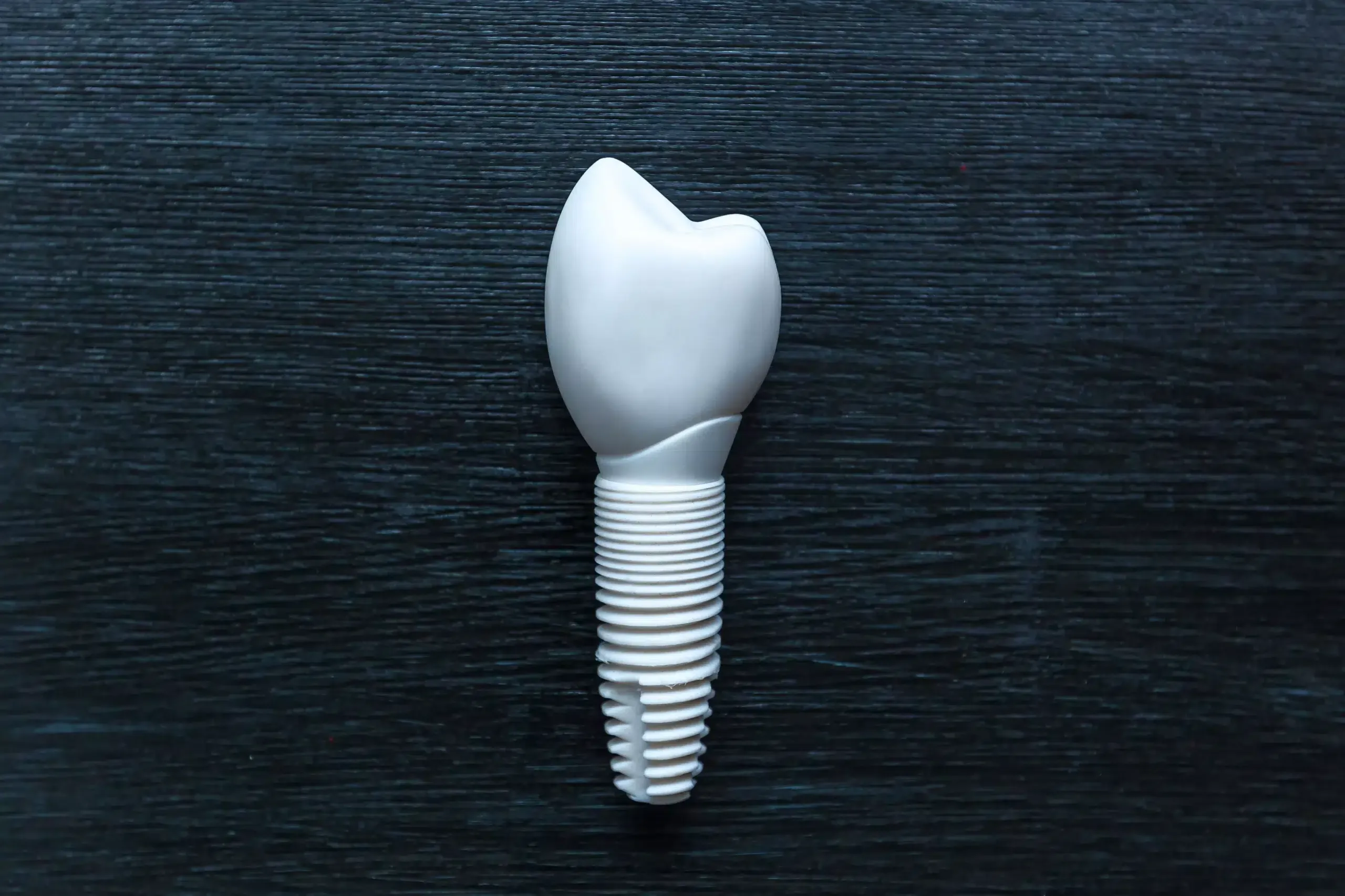 Keramikimplantaten in Köln